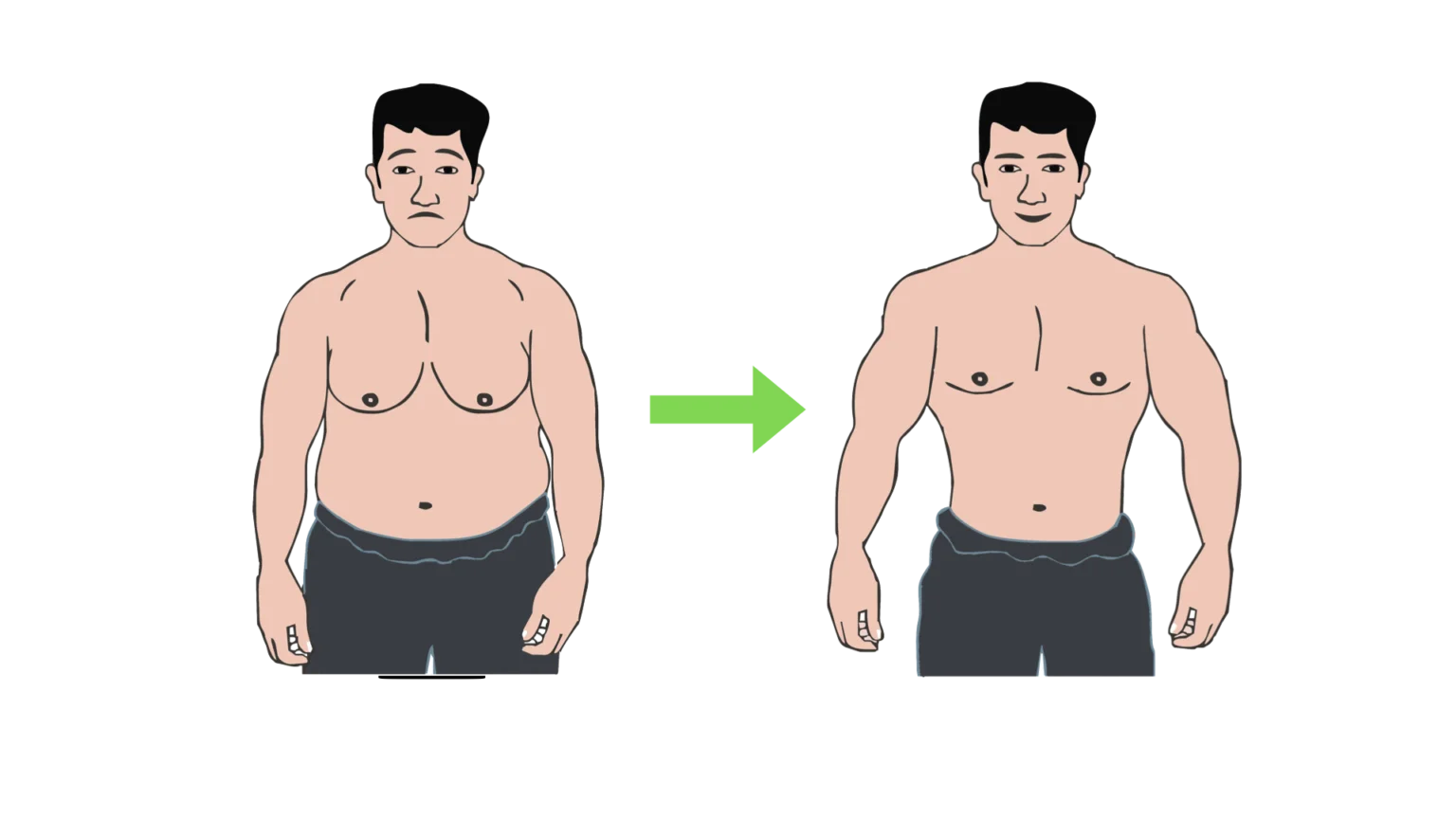 Gynecomastia Surgery in Nashik | Male ...