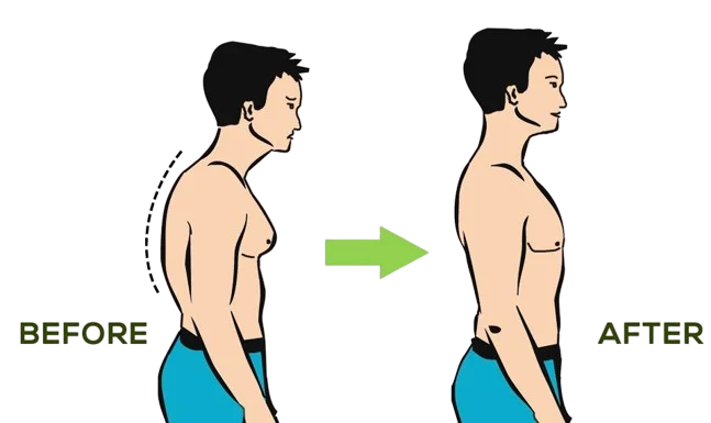 Gynecomastia Surgery in Nashik | Male Chest Reduction